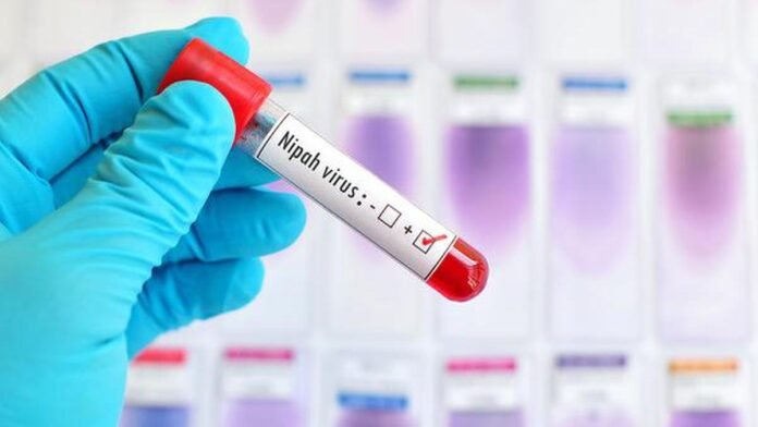 Information on the Nipah virus that you should know